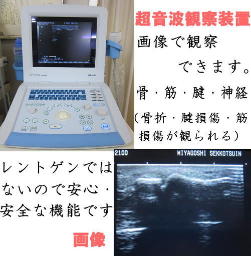 観察装置画像