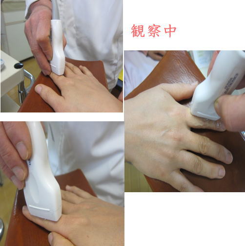 指骨の画像観察